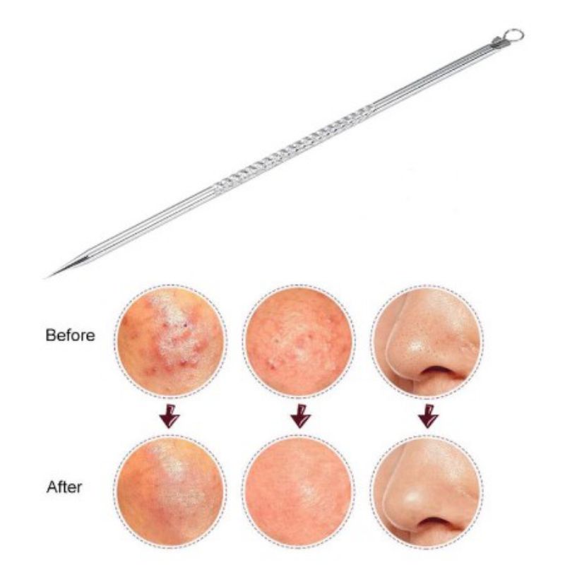 Pinset Komedo 2in1 Alat Pencetan Jerawat Pembersih Jerawat Komedo Blackhead Jarum Facial