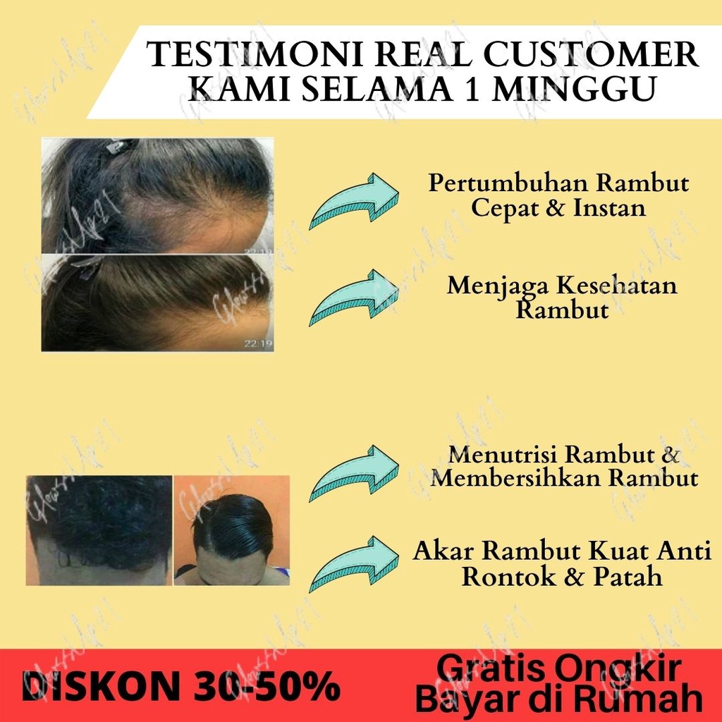 SHAMPOO METAL 100ML PENUMBUH RAMBUT PENYUBUR RAMBUT SHAMPOO METAL SAMPO METAL TREATMENT RAMBUT