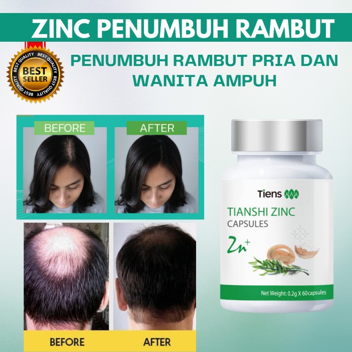 COD zinc penumbuh rambut vitamin / penumbuh rambut botak dan rontok - 60 kapsul segel