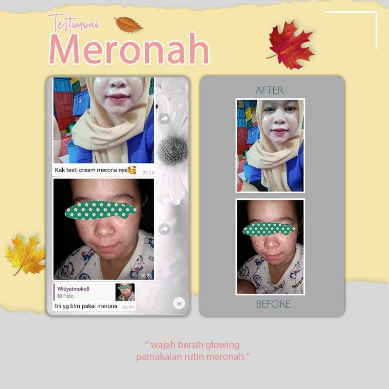 PAKET WAJAH JERAWAT/SENSITIVE/FLEK KUSAM  MERONAH(JERAWAT,BRUNTUS,FLEK)