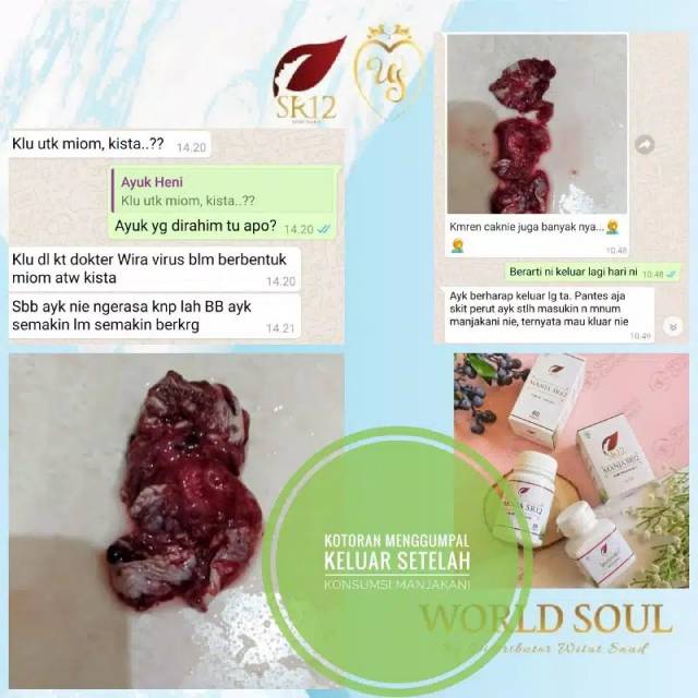 Manjakani SR12 Obat Keputihan Bpom yg Paling Ampuh Vagina Gatal Bau Miss V Rapet dan Keset Ori