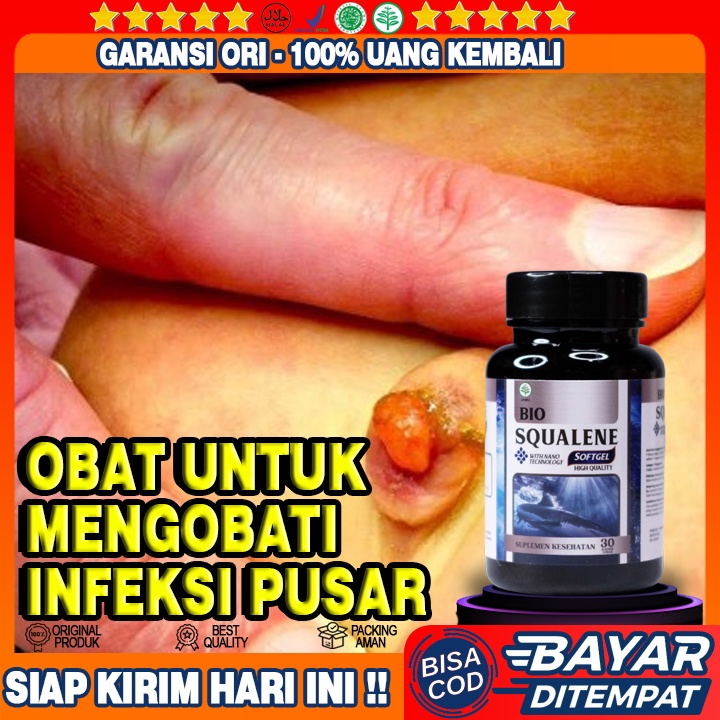 Obat Tradisional Infeksi Pusar - Pusar Nyeri & Mengeluarkan Cairan Bau - Obat Pusar Gatal-gatal - Ob