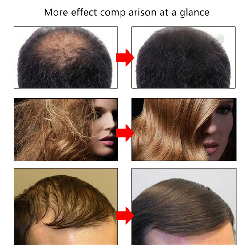 Perawatan Rambut Rontok Serum Rambut Rontok 30ml Semprotan Pertumbuhan Rambut Memelihara akar rambut dan memperbaiki folikel rambut