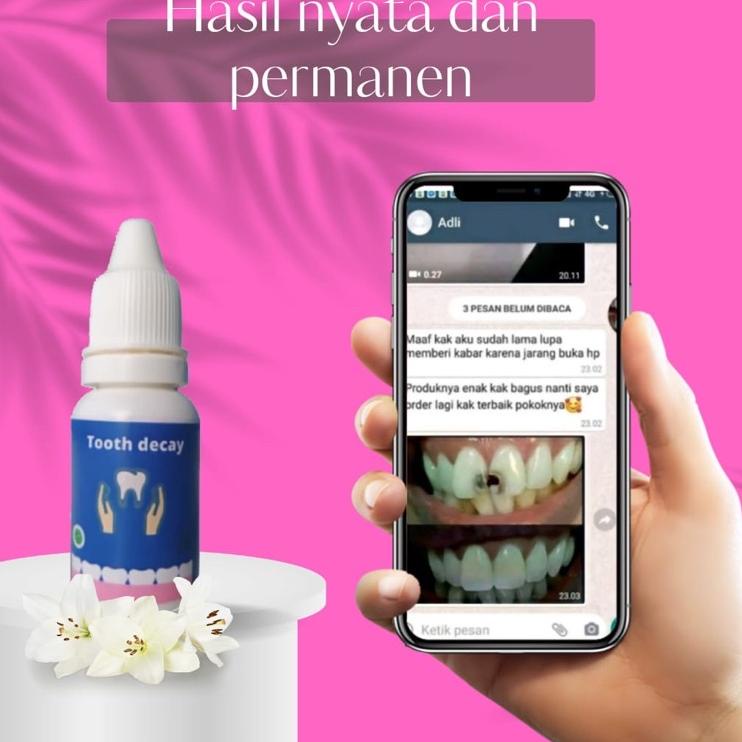 Big Sale Tooth Decay Terlaris Super Ampuh Penumbuh Gigi Ompong & Gigi Berlubang  Penghilang Karang G