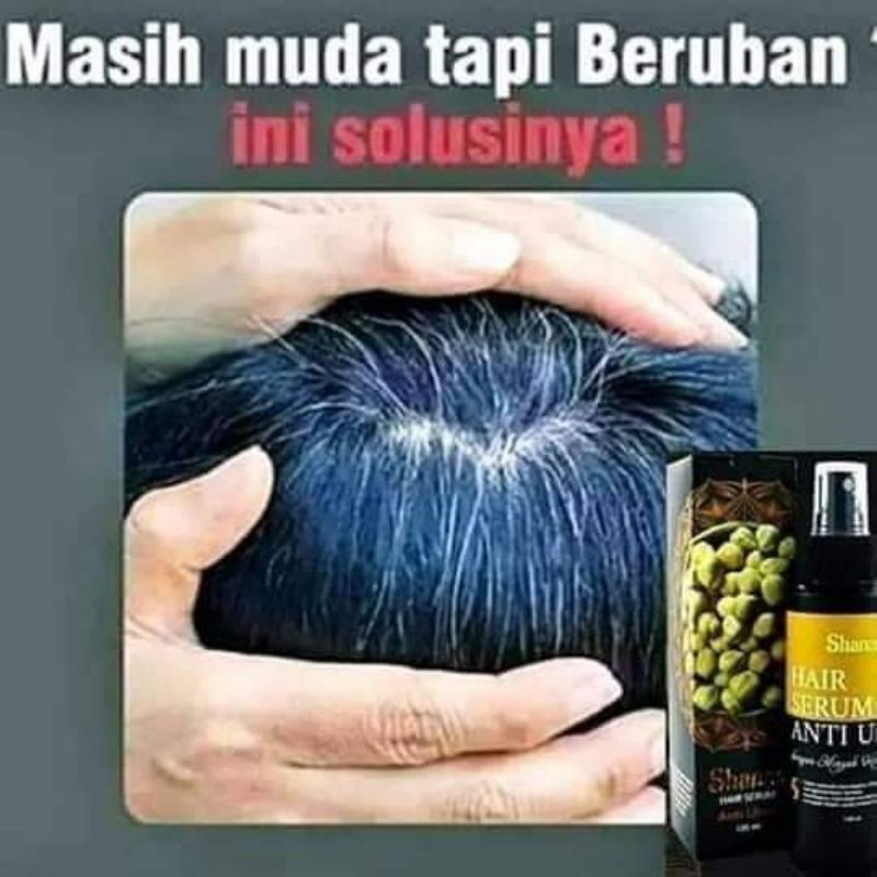 Shanas serum anti uban Hair serum anti uban