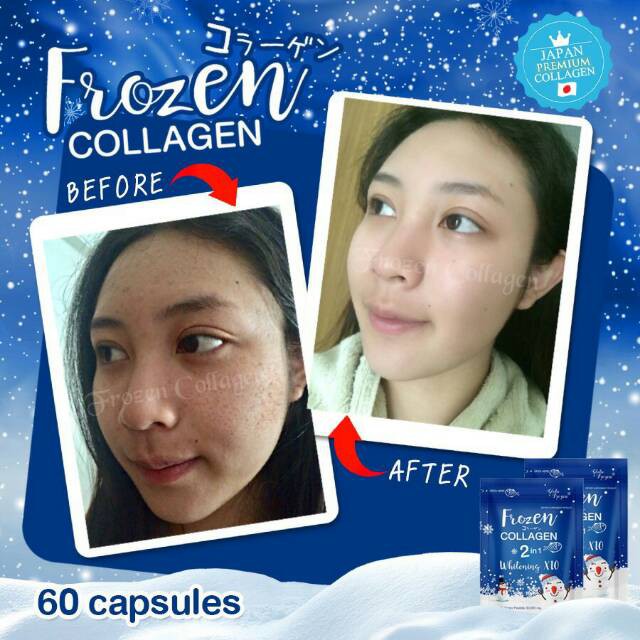 FROZEN COLLAGEN BY GLUTA FROZEN WHITENING GLUTA