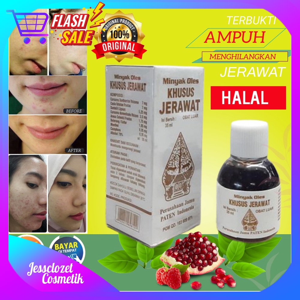 Obat Totol Jerawat Obat Jerawat Dan Bekas Jerawat Paling Ampuh Penghilang Jerawat Dan Bekas Jerawat 