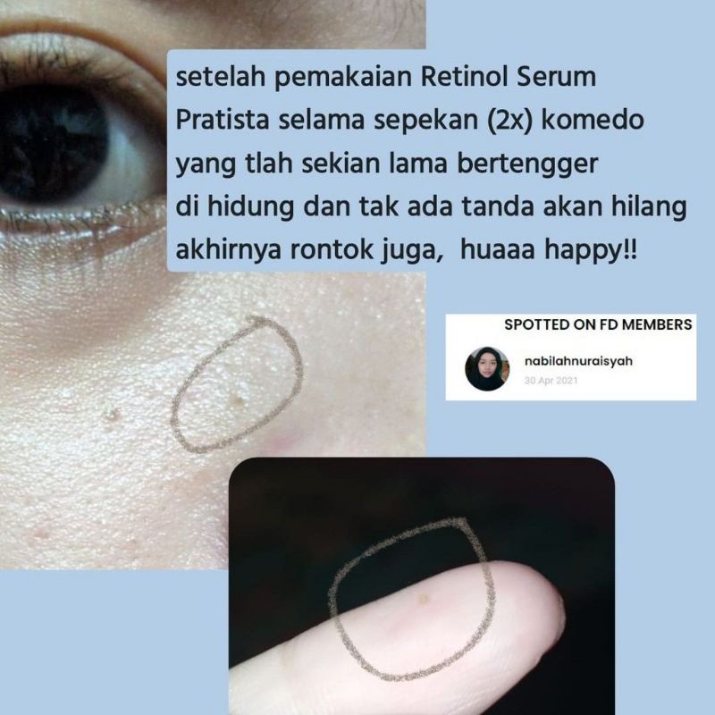 Pratista Retinol Renewal Serum