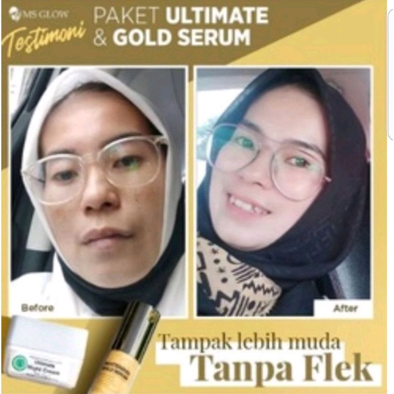 Paket Ultimate+Serum Gold whitening glowing MS GLOW