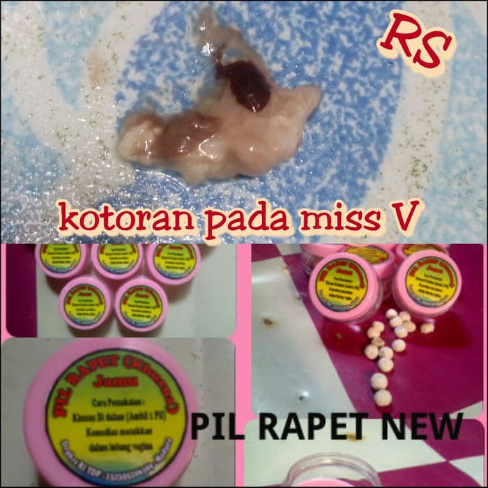 JAMU MADURA PIL RAPET PEMBERSIH KEWANITAAN / MISS V - ju1664