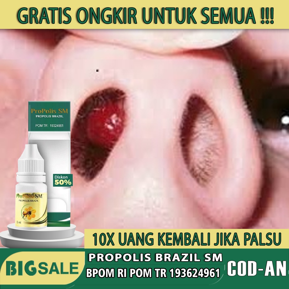 Obat Polip Hidung