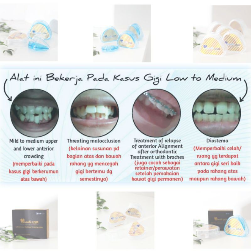 Ismile USA / Ismile USA Transparan ( Fase I ) / Perapih Gigi Original - Hasil Permanen