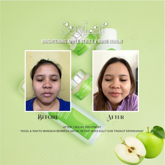 Saylaf - 2 Product Bundling Brightening Krim siang daycream dan serum wajah eachday glowing serum Penghilang flek, jerawat dan memutihkan