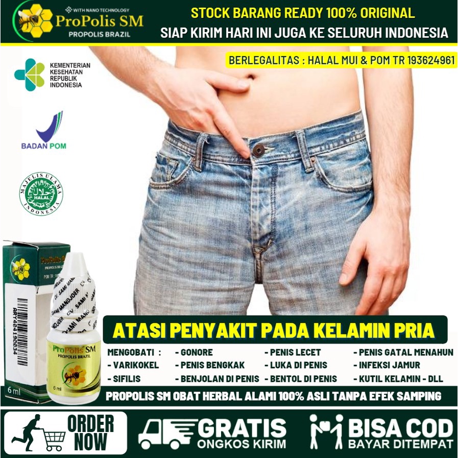 Salep Alami Kepala Penis Gatal, Ujung Penis Gatal, Batang Penis Gatal, Penis Lecet & Perih, Luka di 