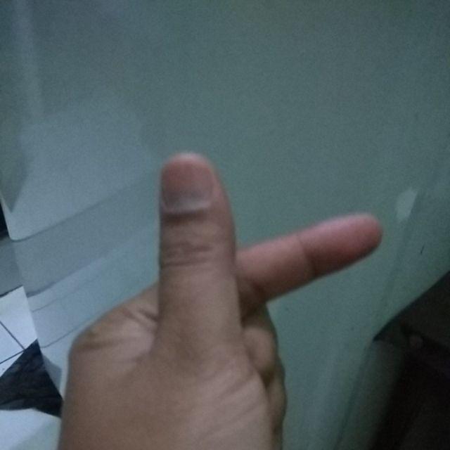 Lunch Box Yooyee 596 Set 910ml Pink