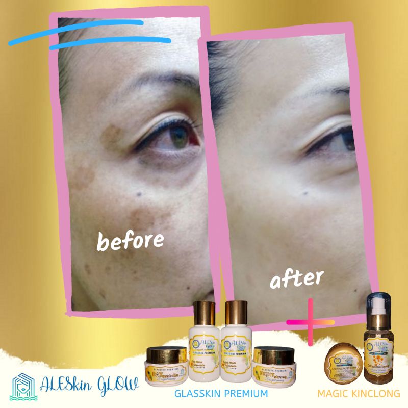 PAKET MAXI GLOW ALESKIN GLOW Skincare Glowing-Paket Perawatan Wajah Korea-Cream Glowing