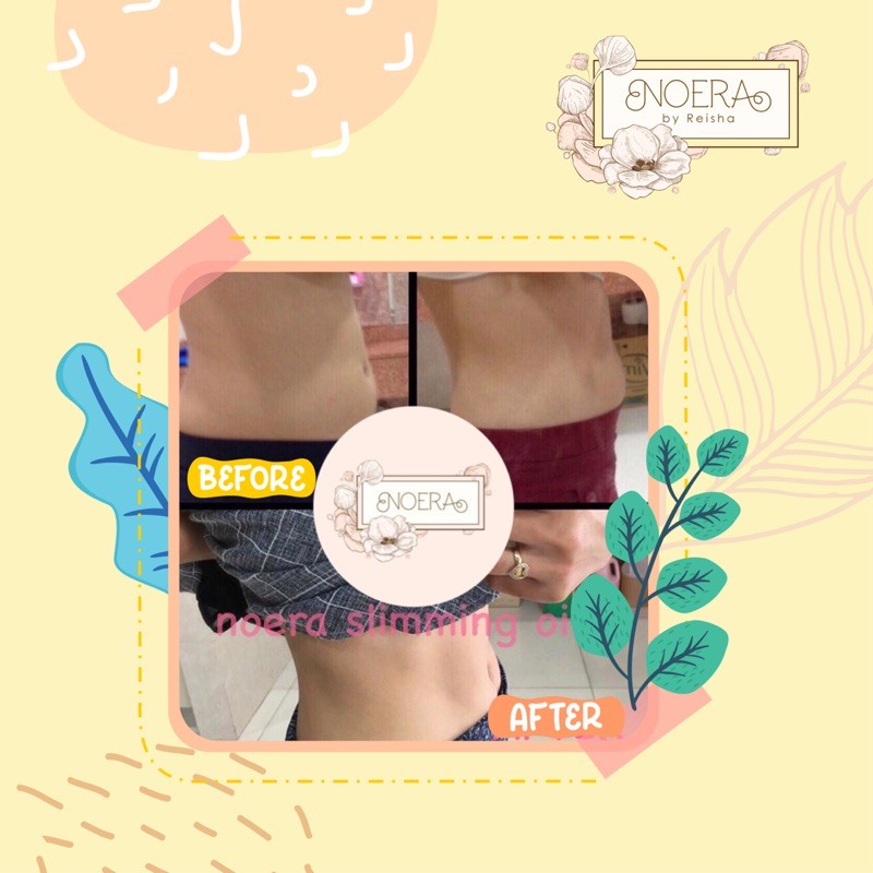 Noera Slim Boost | Pil Diet Noera Slimming Capsule BPOM