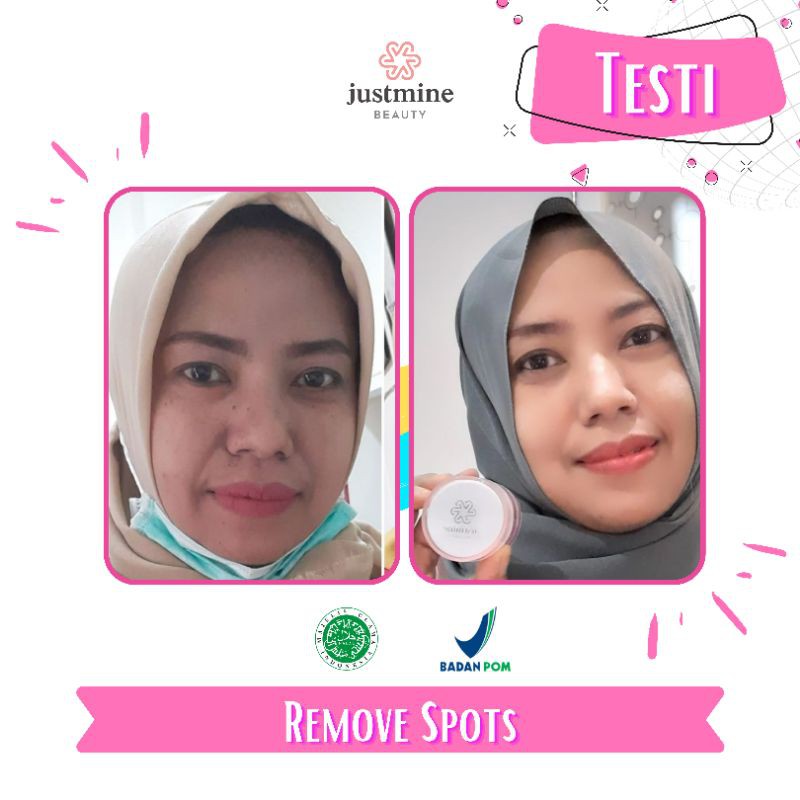 Justmine Beauty Paket Glow dan Remove Spot | Paket Hemat