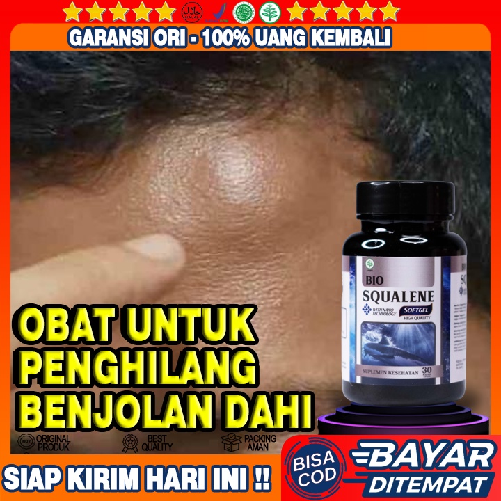 Obat Benjolan di Dahi - Obat Benjolan di Jidat - Obat Benjolan di Dahi Kiri Kanan - Obat Benjolan di