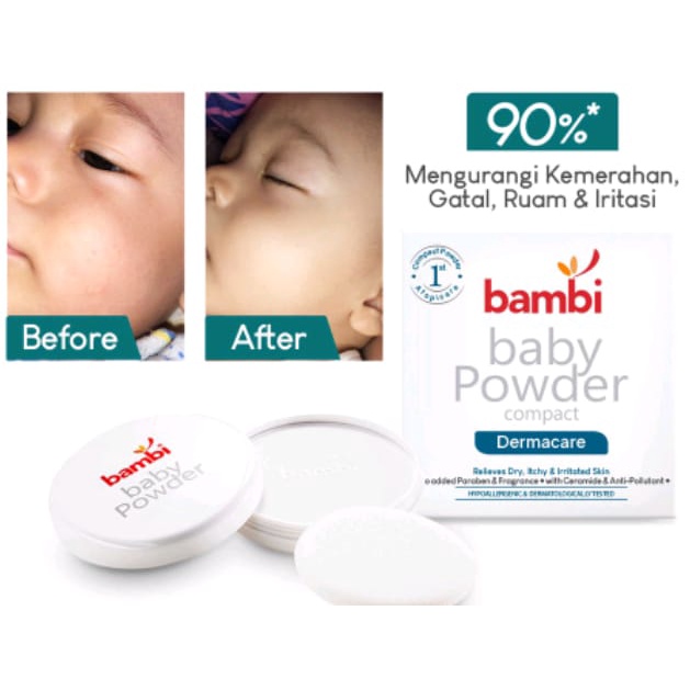 Bambi Baby Dermacare Daily Soothing &amp; Calming Theraphy Head To Toe Wash 200ml / Advanced Moisture Body Lotion 200ml /Powder Compact Dermacare 40gr