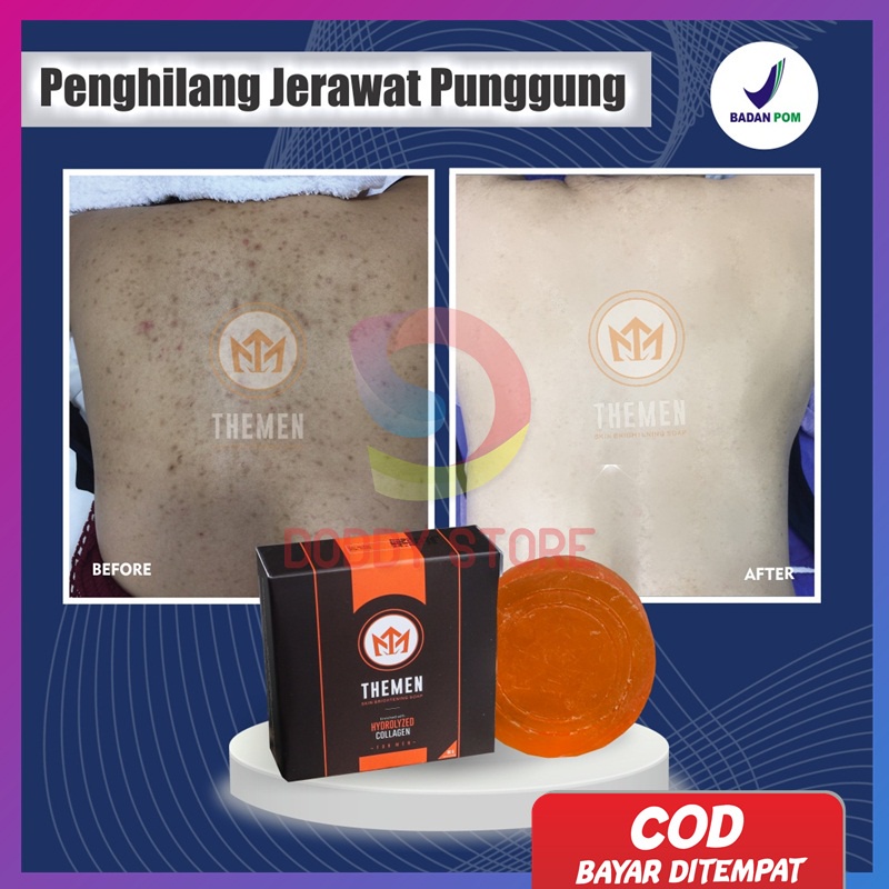 Ampuh Menghilangkan Jerawat di Punggung Pria BPOM - Sabun perawatan jerawat - Sabun jerawat pria - S
