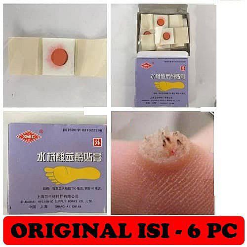 Plester Obat Kutil & Mata Ikan Penutup Kutil Koyo Kutil ji yan gao Menghilangkan di Seluruh Area Sam-1