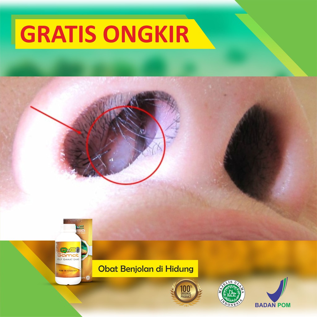 Obat Benjolan Benjolan Di Hidung Benjolan Di Hidung Anak Qnc Jelly Gamat Shopee Indonesia