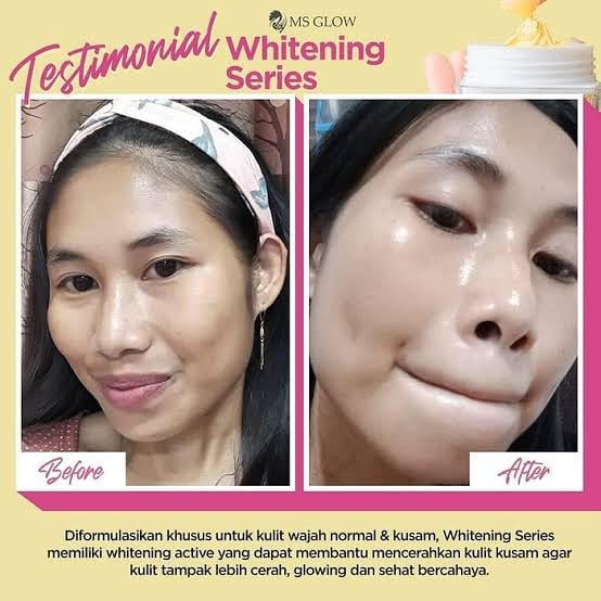 Ms Glow Paket Whitening - Perawatan Wanita Mencerahkan Kulit Kusam Melembabkan Kulit Kering Aman