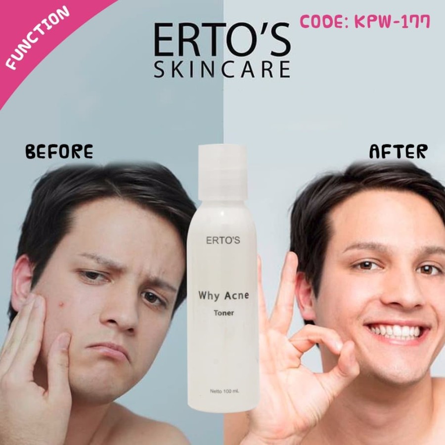 ERTOS WHY ACNE TONER UNTUK WAJAH BERJERAWAT