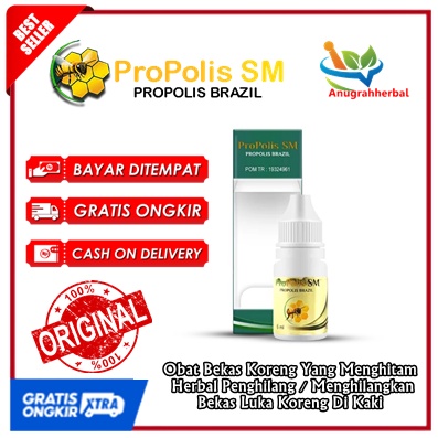 Obat Bekas Koreng Yang Menghitam, Herbal Penghilang / Menghilangkan Bekas Luka Koreng Di Kaki, Bekas