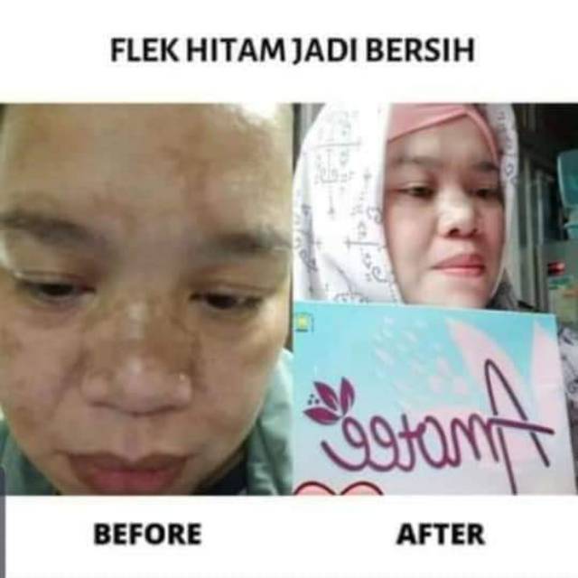 

Amotee minuman untuk perawatan kulit dari dalam