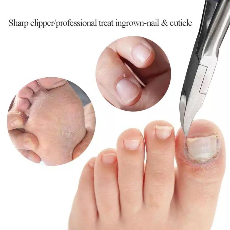 Tang Gunting Kuku Jempol Kaki Miring Stainless Steel Anti Cantengan Toe Nail Clipper Kulit Mati Dan Kutikula Nipper F712