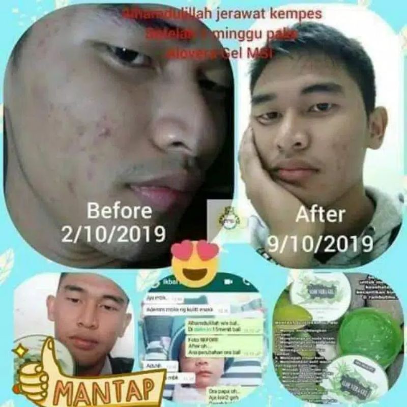 ALOE VERA GEL ORIGINAL