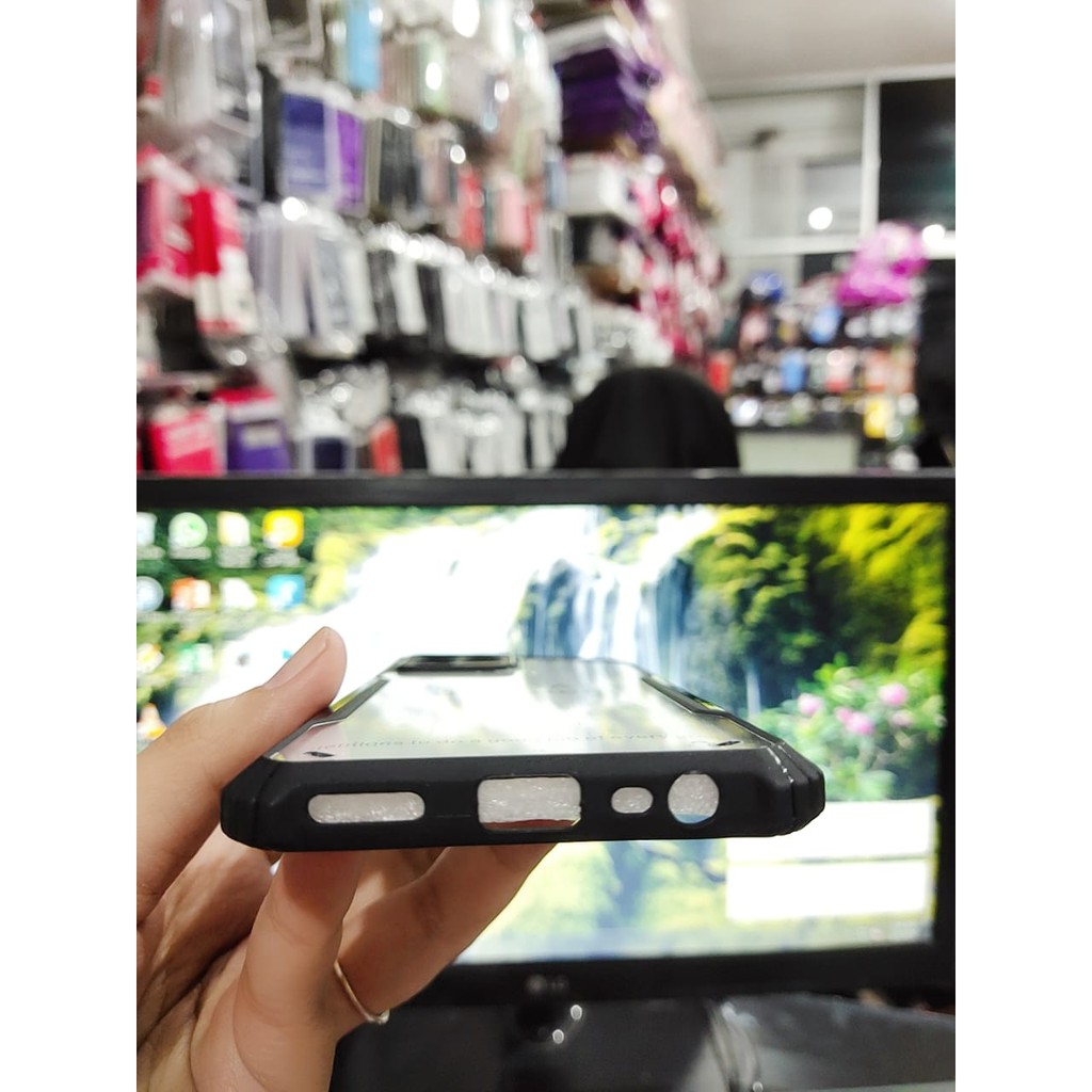 Anti Shocking Realme 8 8 Pro 6.4 Inchi Hardcase List Hitam Acrylic Case