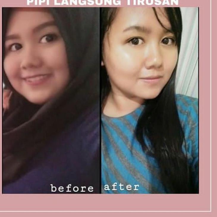 [COD] Sft Extra Slim | 1 Day 1kg