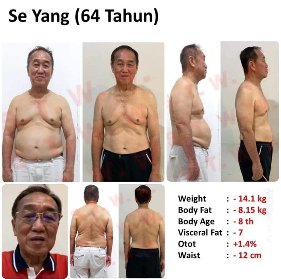 Baut Mur Kuning - Bmk M6 X 35 Mm