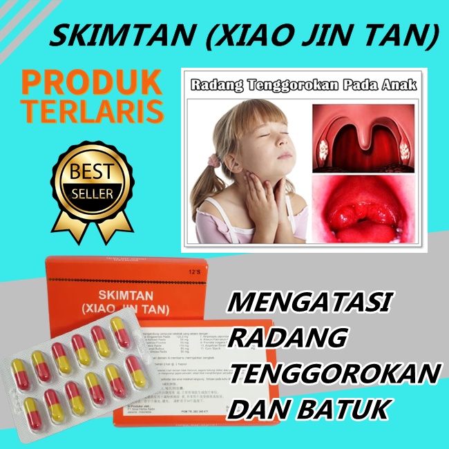 Best Produk Obat sakit tenggorokan cina skimtan xiaojintan pereda batuk anak dan dewasa paling ampuh