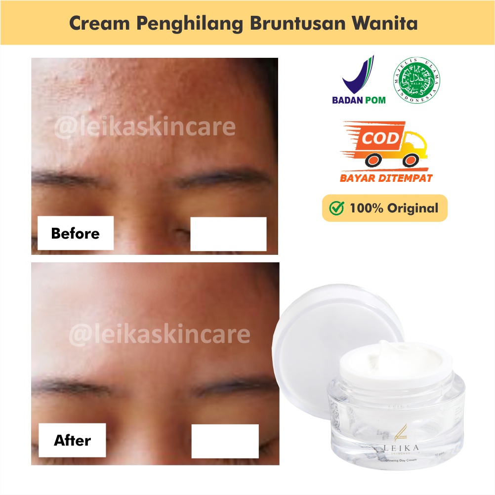Krim Bruntusan Ampuh Cream Wajah Terlaris Krim Penghilang Bruntusan Perawatan Kecantikan Bpom Halal 
