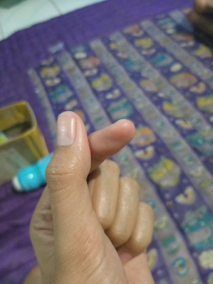 Ss Balmut Lady Rose 160x220 Cm Bantal Selimut Anak Dewasa Termurah Grosir Mix Part B