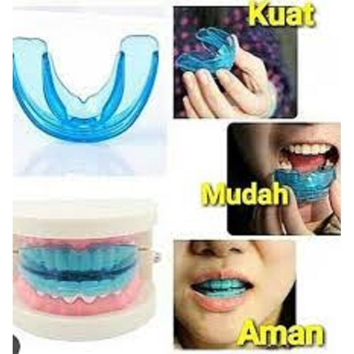 PERAPAT DAN PERATA GIGI - DESSA DENTAL USA - TEETH TRAINER ALIGNMENT