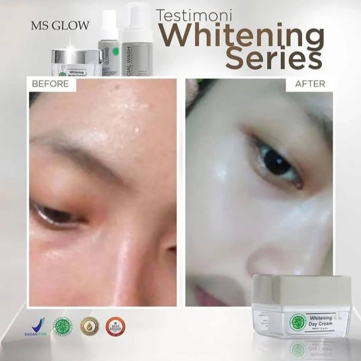 MS GLOW SKINCARE PAKET WHITENING SERIES UNTUK PEMUTIH DAN PENCERAH WAJAH