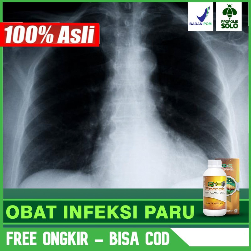 

Obat Gatal - Gatal, Jamur Kulit, Alergi Dingin, Kurap, Panu QNC Jelly Gamat Herbal Terlaris Bisa COD