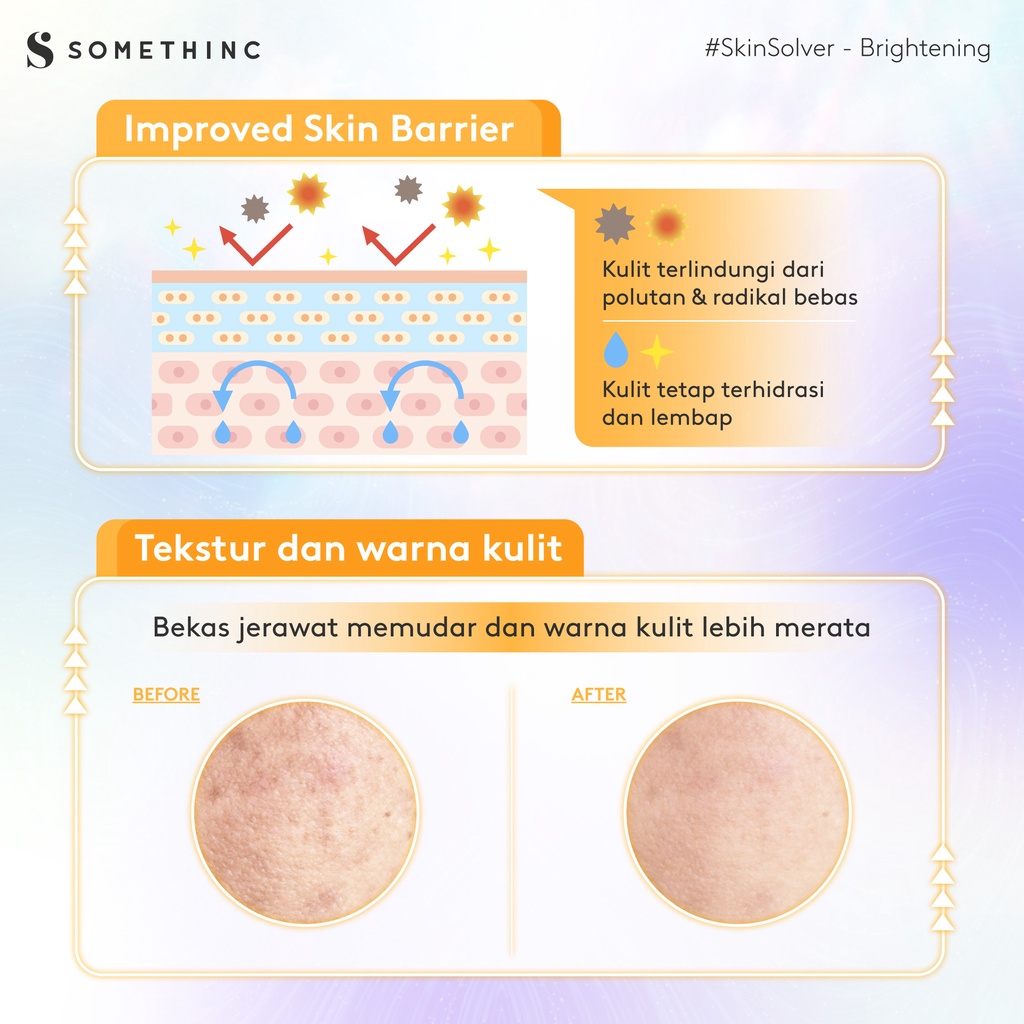 SOMETHINC 5% / 10% Niacinamide + Moisture Sabi White Max Brightening Serum Whitening Lightening Pencerah Pemutih Niacin