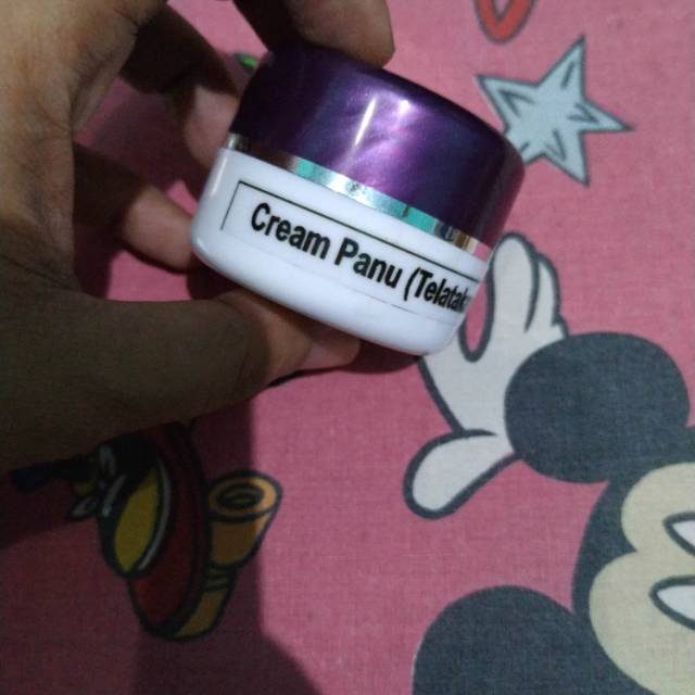 Cream Panu / Panu Wajah / Panu Punggung / Obat Panu Ampuh / Obat Panu Anak / Obat Panu Kadas Kurap