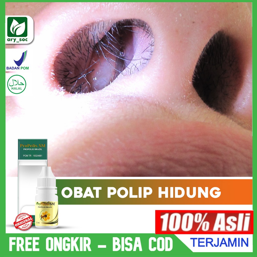Obat Tetes Polip Hidung - Sinusitis  - Radang Sinusitis - Hidung Mampet, Tersumbat - Flu Propolis SM