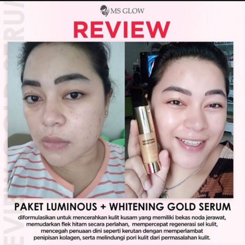 MS Glow Whitening Gold Serum 15ml