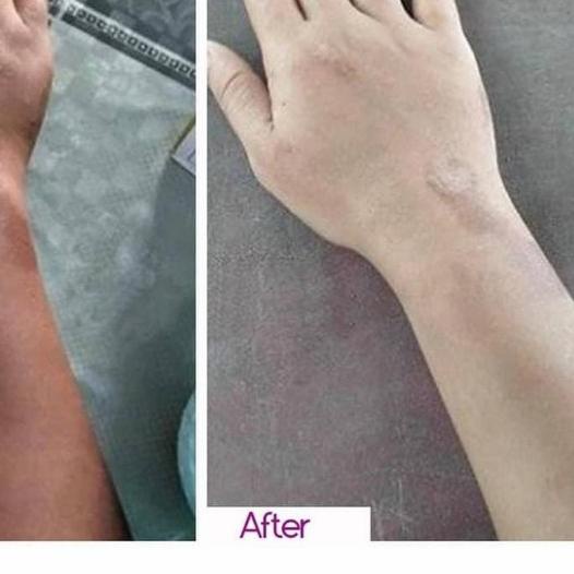 ✹ whitening scar soap sabun pemutih - Beli 1 Gratis 1 ☀