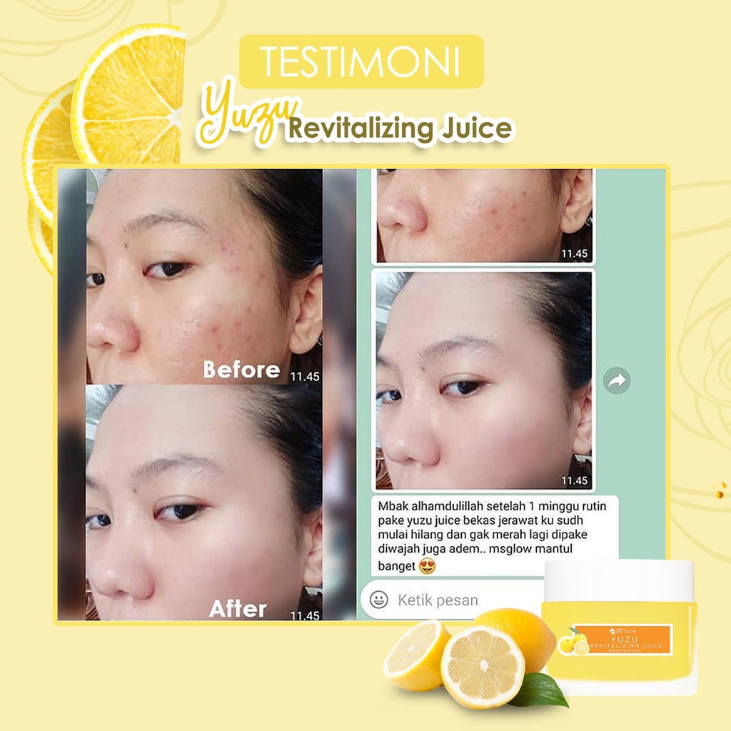 YUZU Revitalizing Juice MS Glow ORIGINAL - Perawatan Kecantikan Kulit Wajah Berjerawat Beruntusan - Beauty Skincare BPOM