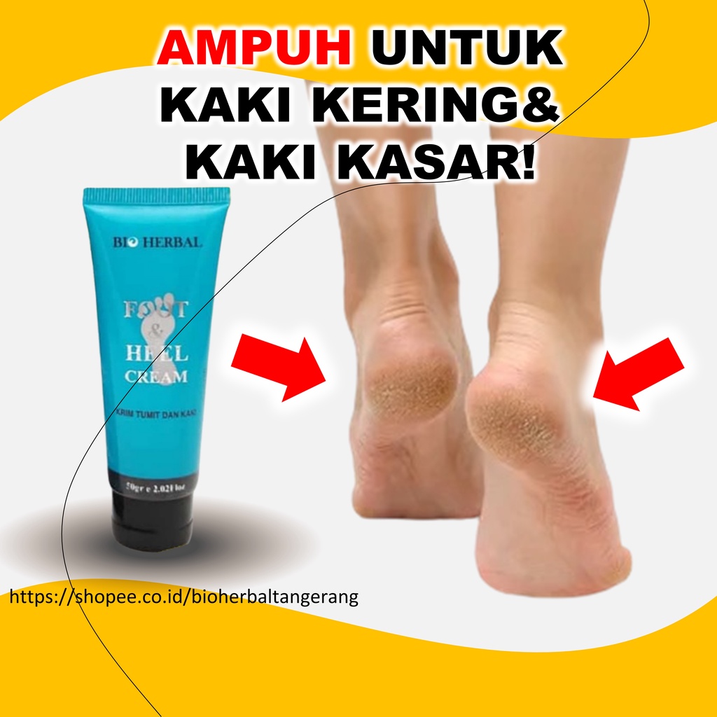 Jual Salep Kaki Pecah Dan Kering Paling Ampuh BPOM B10R Shopee Indonesia