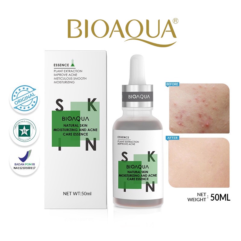 BIOAQUA Natural Skin Moisturizing and Acne Care Essence Serum Wajah